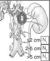 N-CATEGORIES: SIZE AND NUMBER Example: Renal pelvis and ureter N1 single