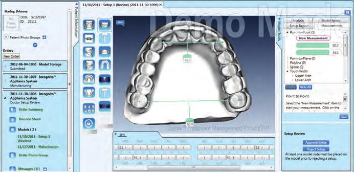2 Figure 2 100% Customized Orthodontics One of the biggest advances in modern orthodontics is the utilization of technology to deliver customized brackets, wires, and treatment forecasts to enhance