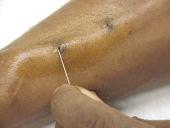 Avoid cannulation mishaps /hubbing 1.