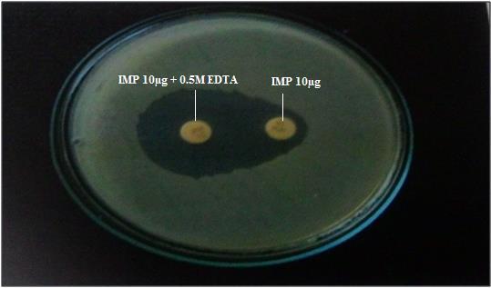 Img 1: Detection of MBL in E.coli by DDST.