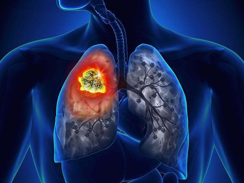 Lung Cancer Older patients with completely resected NSCLC derive similar benefits of adjuvant chemotherapy compared to younger counterparts A pooled analysis of 4,000 patients from