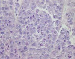 Two tumors for each treatment protocol were analyzed by microscopy and