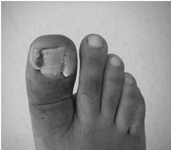Foot Lesions 6.