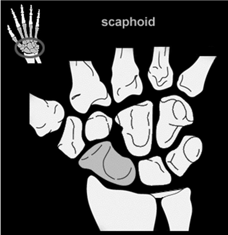 Scaphoid Basics Anatomic points Dipped in cartilage Peculiar shape Link proximal &