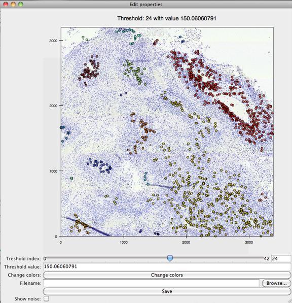 HOT-SPOT detection by a clustering method Result visualization Possible manual adjustment by pathologists