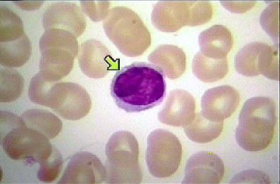 There are three types of granules: neutrophil, acidophile,