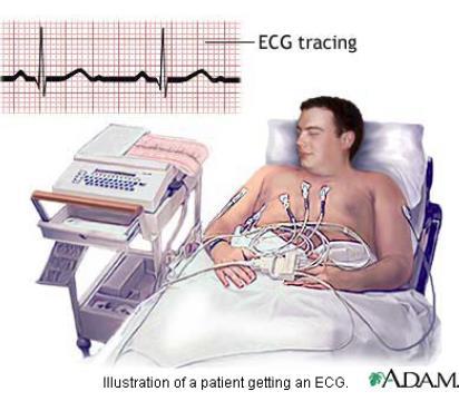 Electrocardiograms (ECG or EKG)