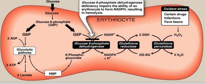 G6PD deficiency - This enzyme is the rate limiting enzyme in the PPP.