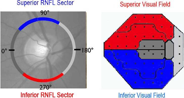 Optical Imaging Predicts Visual Field Loss in NAION IOVS j August 2013 j Vol. 54 j No. 8 j 5515 FIGURE 1. Corresponding peripapillary RNFL sector and regional visual field mapping.