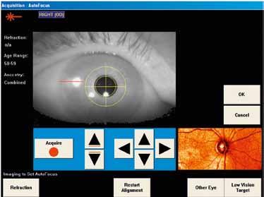1 Live Fundus View Scan Acquisition Screen 2 Low Vision Target 3 AutoFocus Designed with the clinician in mind GDxPRO integrates clinical performance with workflow efficiencies.