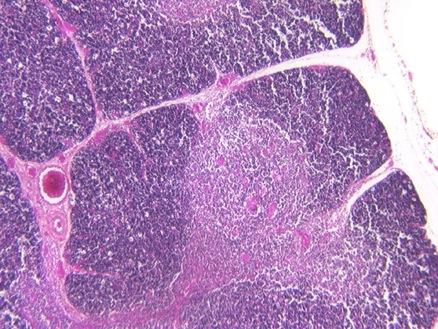 Thymus medullary epithelium is derived