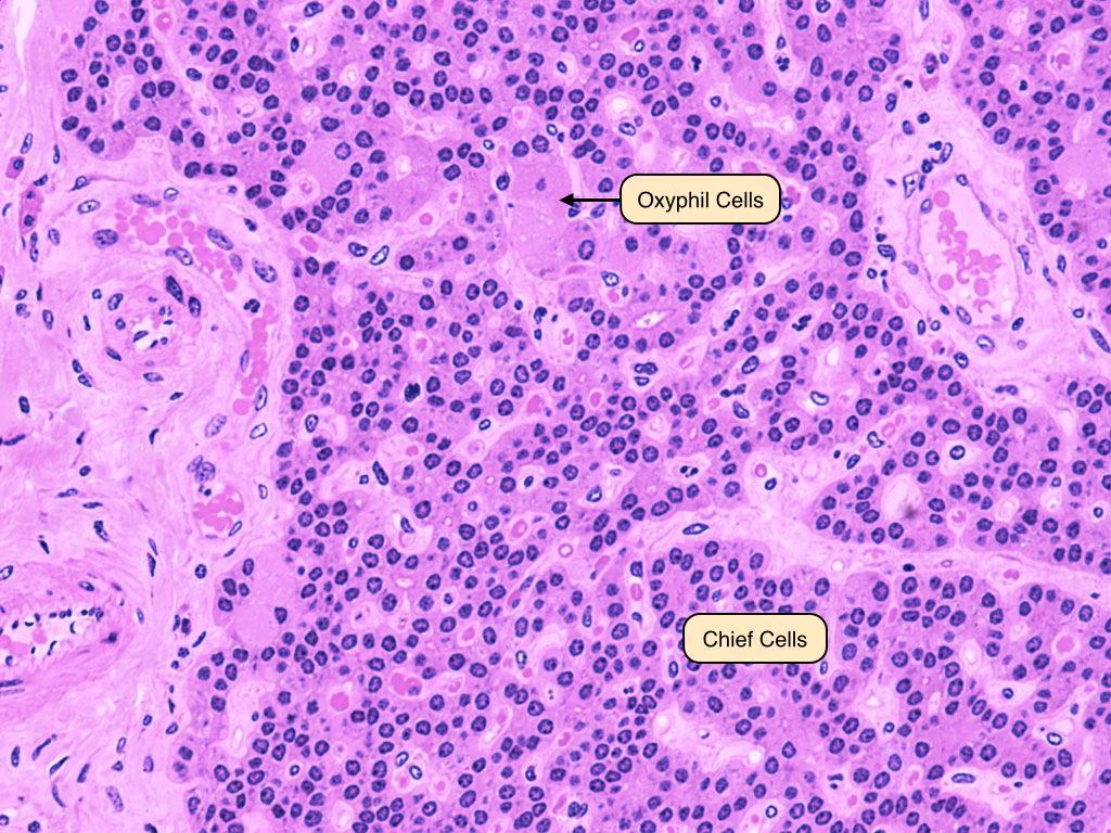Numerous, small cells with prominent nuclei and pale cytoplasm Chief