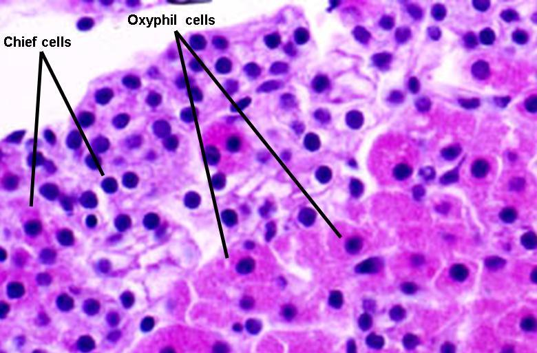 Oxyphil cells Less numerous, appear in groups Cytoplasm is