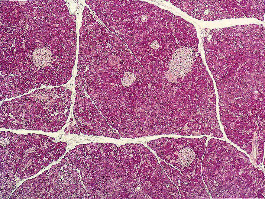 Low magnification of the Pancreas