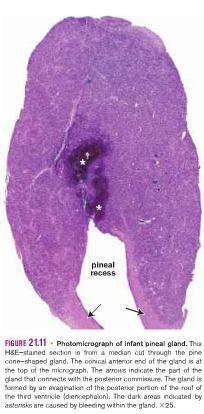 The pineal gland contains two types of parenchymal cells: