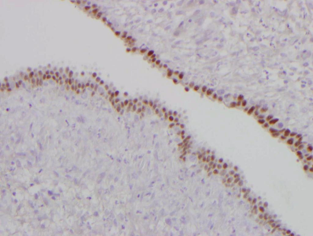 Image demonstrates smooth muscle in the cyst