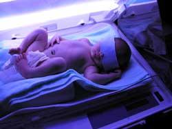 Potential effects on a baby during birth/infancy: Premature delivery Structural brain abnormalities Low birth weight Growth and