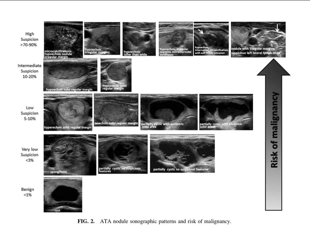 ATA nodule sonographic pattern From 2015 American Thyroid Association Management Guidelines for