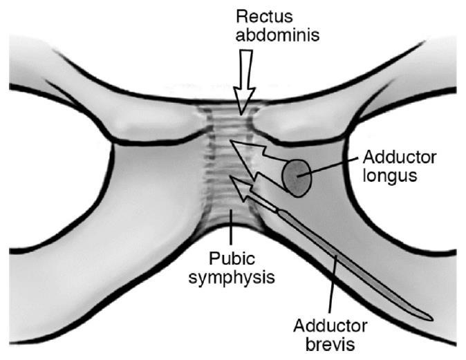Muscles acting upon pubic symphysis