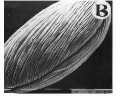 Bauhinia variegate: A, Polar view; B- Equatorial