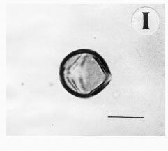 ) Swartz Pollen type-iii: Senna holosericea-type (Fig.