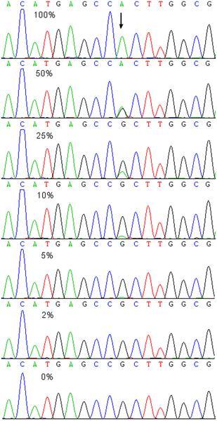 DNMT3A sequencing for R882H/S on exons 23 Lin J, Yao Dm, Qian J, Chen Q, Qian W, et al.