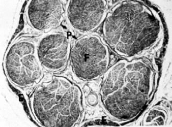 Fascicular Pattern of the Inferior Alveolar Nerve. Svane. J Oral Maxillofac Surg.