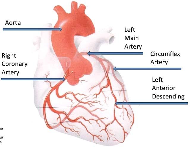 Coronary Arteries Branch from the Aorta into left and Right Right: Right coronary Artery (RCA)
