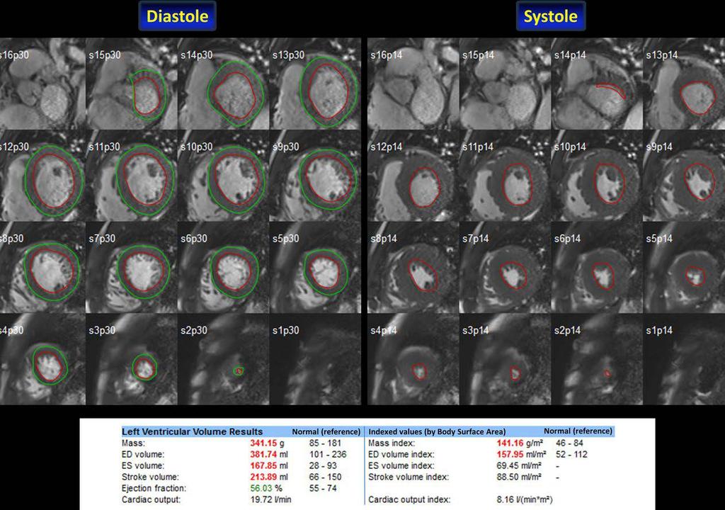 Cardiac MRI Most descriptive Several slices of the heart