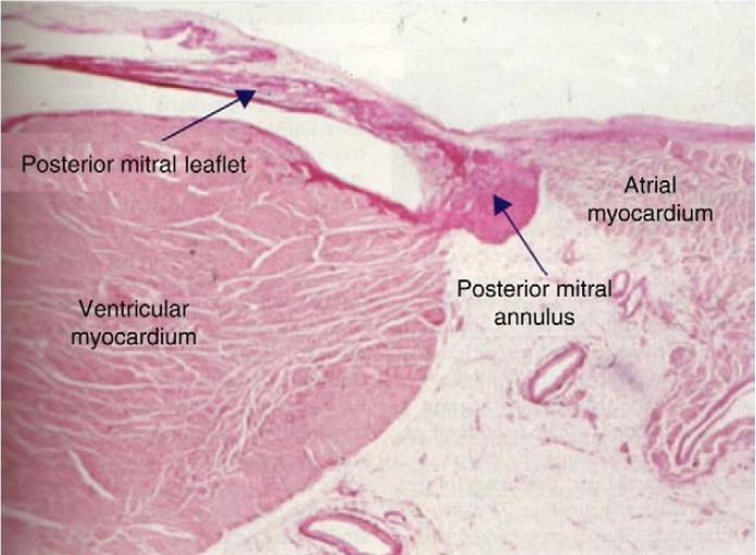 Posterior Mitral Annulus More muscular with areas of fatty tissue More