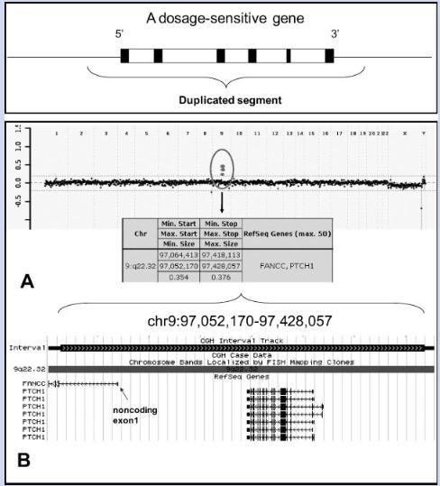 Microduplication of an Entire Single PTCH1 gene Gene 360 kb duplication in 9q22.