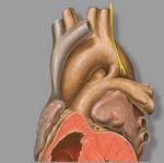 Slide 16 PATENT DUCTUS ARTERIOSUS Slide 17 PATENT DUCTUS ARTERIOSUS Accounts for 10% of all congenital heart defects.