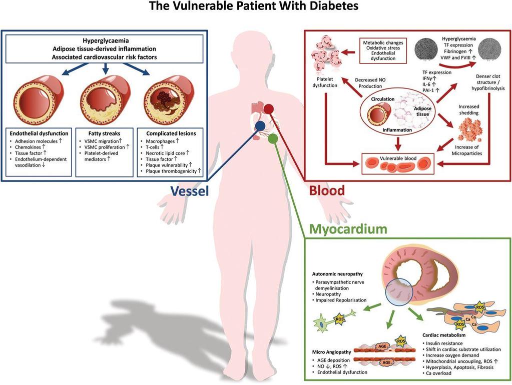 The vulnerable patient with diabetes