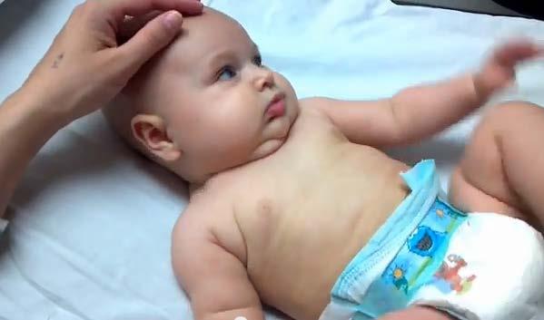 This infant presents to your office with recurrent croup,