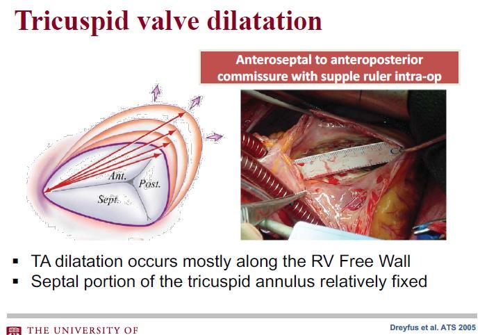 TRICUSPID VALVE ANATOMY AND PHYSIOLOGY The septal portion of the annulus subtends the right fibrous trigone and is supported by the cardiac skeleton the mural portion of the annulus