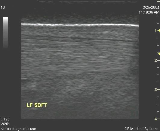 April 25 th, 2007 On April 25 th the ultrasonographic appearance of the tendon was substantially improved with the defect being filled and the fiber pattern normalized.