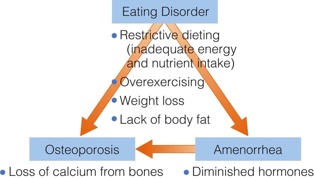 Eating Disorders The Female Athlete Triad