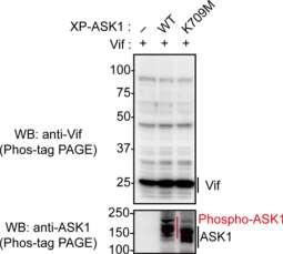 Supplementary Figure 4 Supplementary Figure 4. ASK1 seems not to induce Vif phosphorylation.