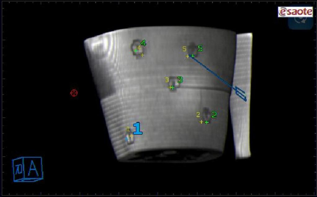 Fig. 7: Registration between Ultrasound and MRI volume using Virtual Navigator Registration Pen in order to match the