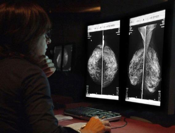 Hands-on Breast Screening and Diagnosis Course * Screening of 510 full field digital mammography cases. * Reading a mixture of normals and proven abnormals at high resolution viewing stations.