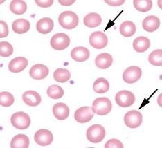 hematopoietic system How blood cells are
