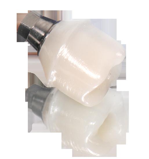 Abutments are specially designed in order to maintain the prosthesis of