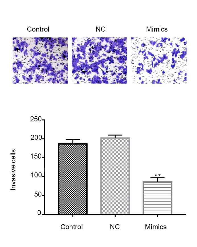 FIGURE 4. Inhibited cell migration and invasion of MCF-7 after mir-361-5p mimics transfection. Transwell assay of MCF-7 and the number of invasion cells.