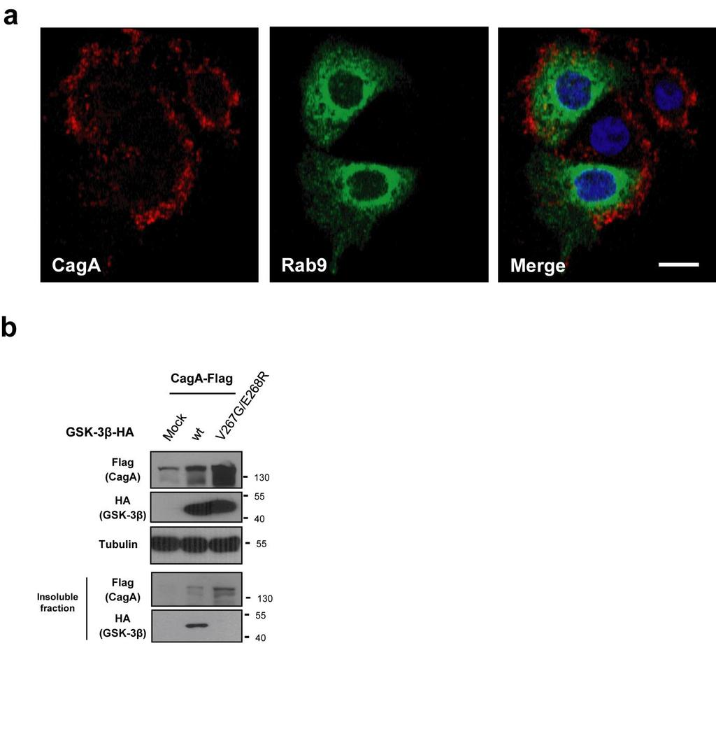 Supplementary Figure 5. (a) The independent localization of CagA and Rab9, a marker of late multivesicular endosome.