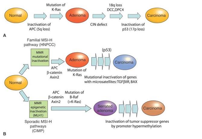Three Genetic pathways to colorectal carcinoma.