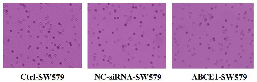cell migration in the experimental group was significantly decreased (100X magnification). Figure 5. Reduction of ABCE1-SW579 cell invasion in vitro (200X magnification).