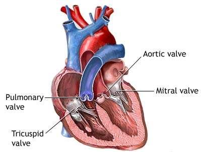 *C.V. was born the 24th May 1980 Rheumatic fever during childhood Normal development until adulthood.