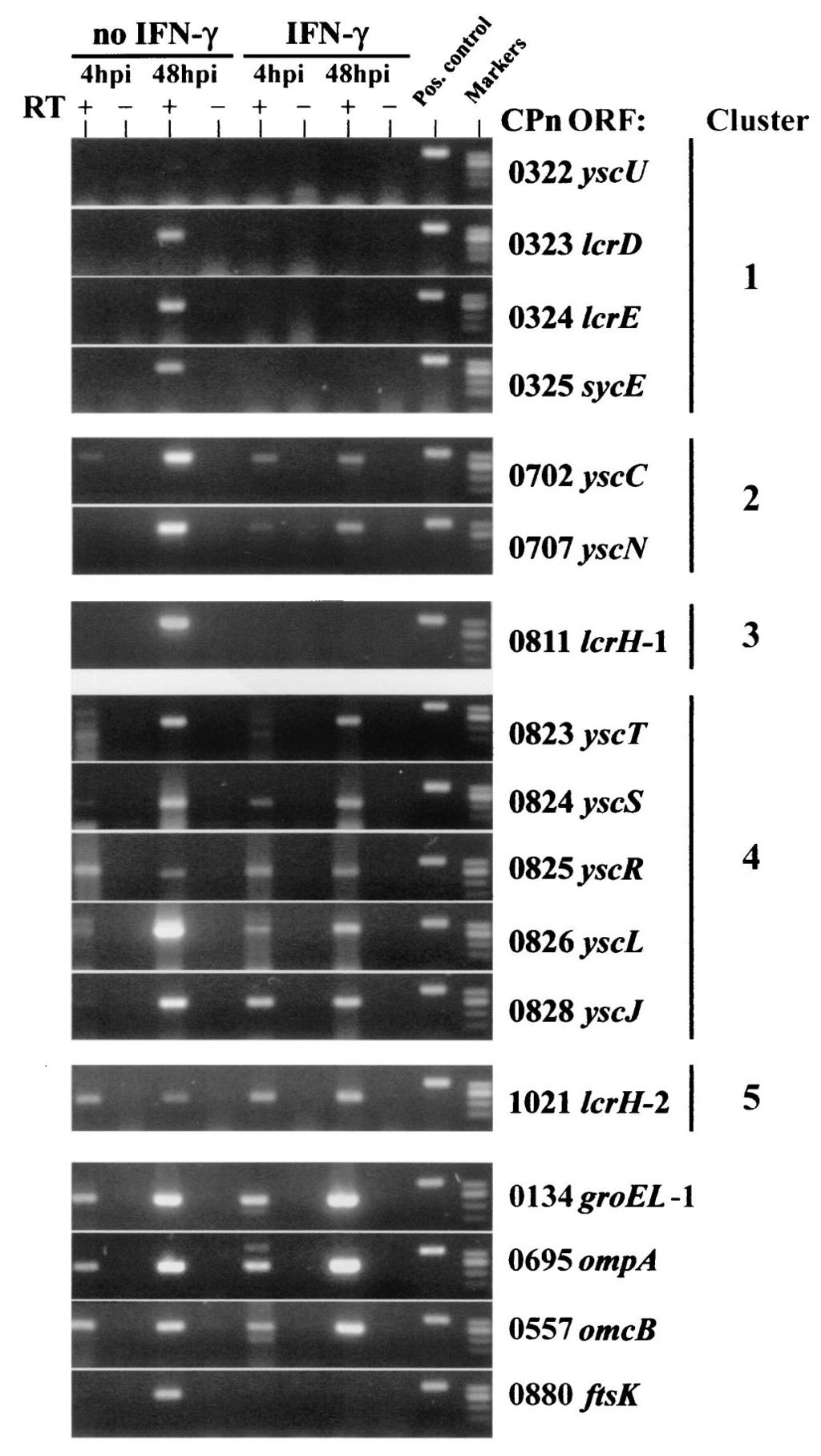2560 SLEPENKIN ET AL. INFECT. IMMUN. FIG. 5. HEp-2 cells were infected with C. pneumoniae CM-1 with and without IFN- (40 ng/ml). Infected monolayers were incubated at 37 C, and at 4 and 48 h p.i., cells were harvested and RNA was isolated.