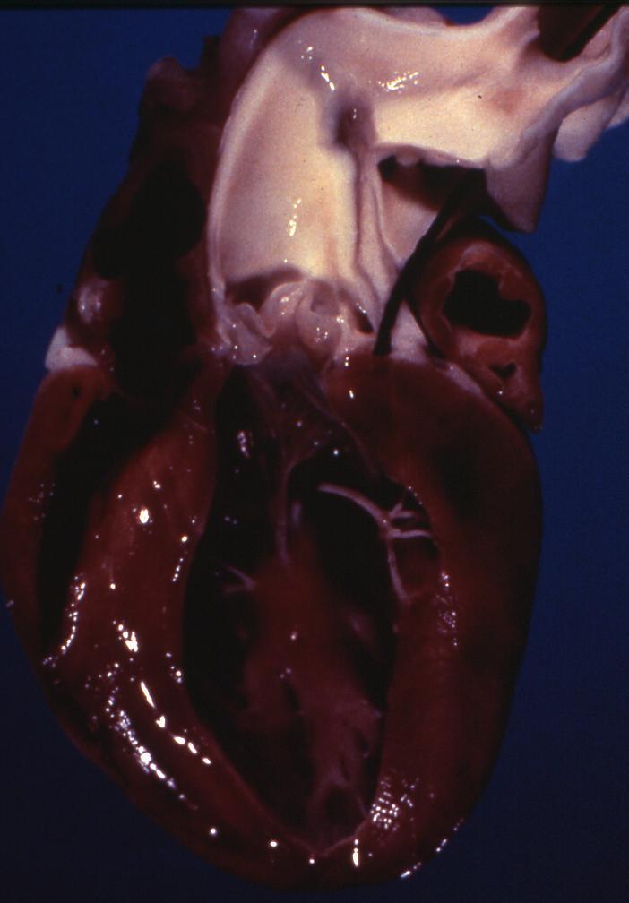 Case 4 11-week-old English Springer Spaniel with bilateral cardiomegaly. The heart weight was 3.1% body weight(!!!).