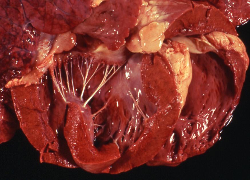 Case 11 Heart from a cow.